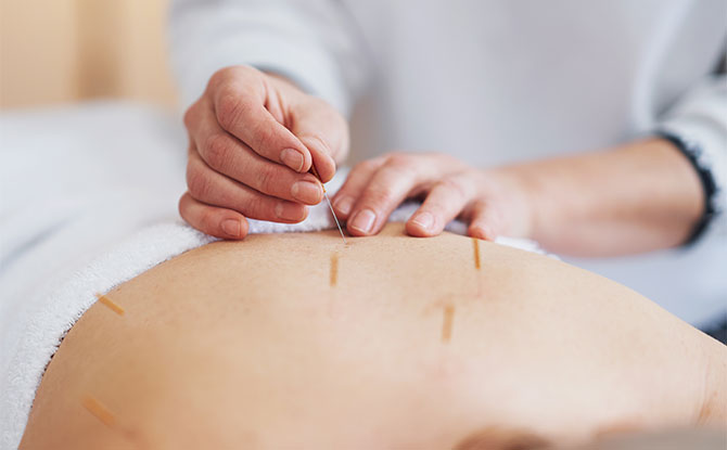 19 Acupuncturist Jokes That Get To The Point